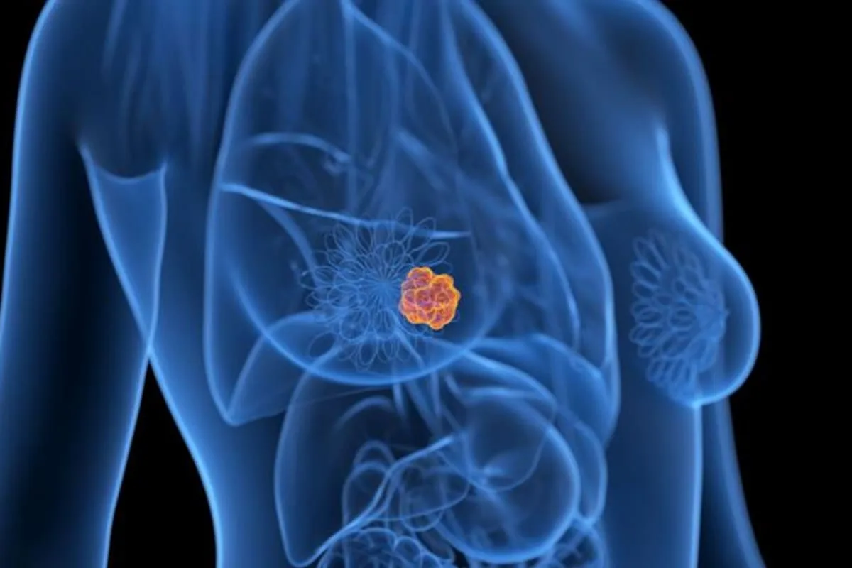 Cuándo hacerse una mamografía si hay antecedentes familiares de cáncer de mama