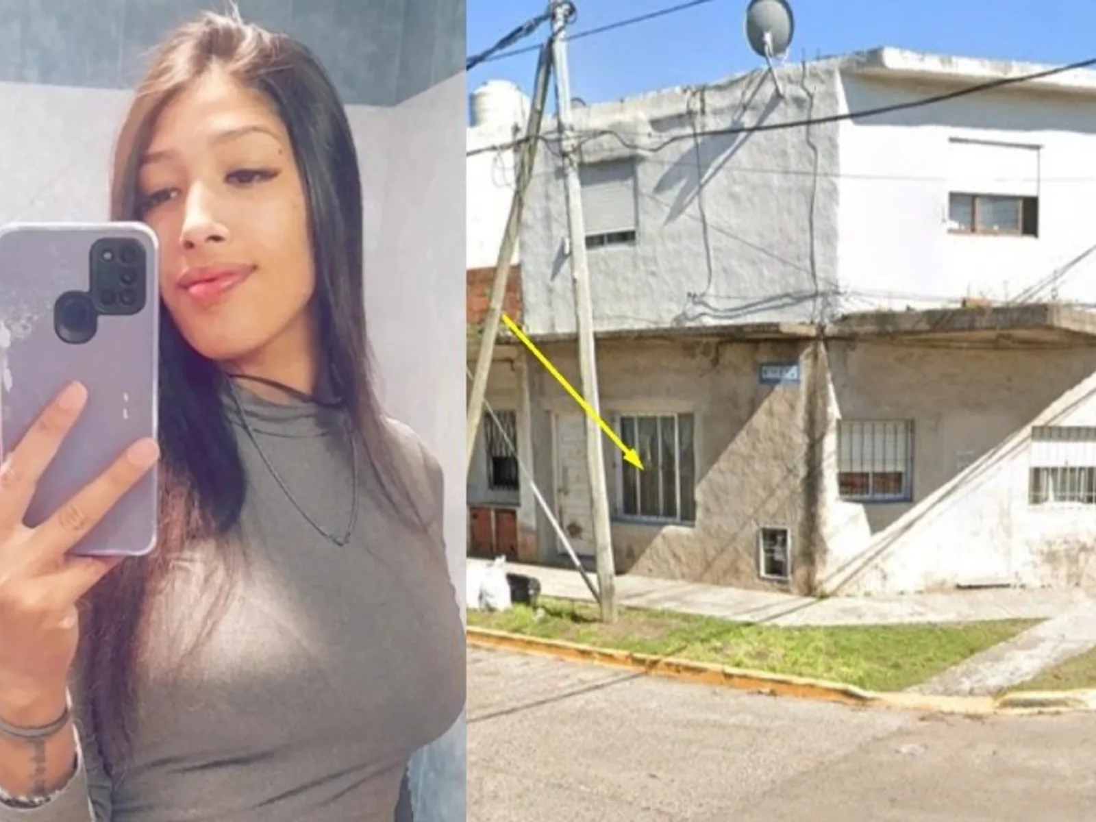 Mujer de 25 años está grave tras recibir ácido en la cara en Tres de Febrero