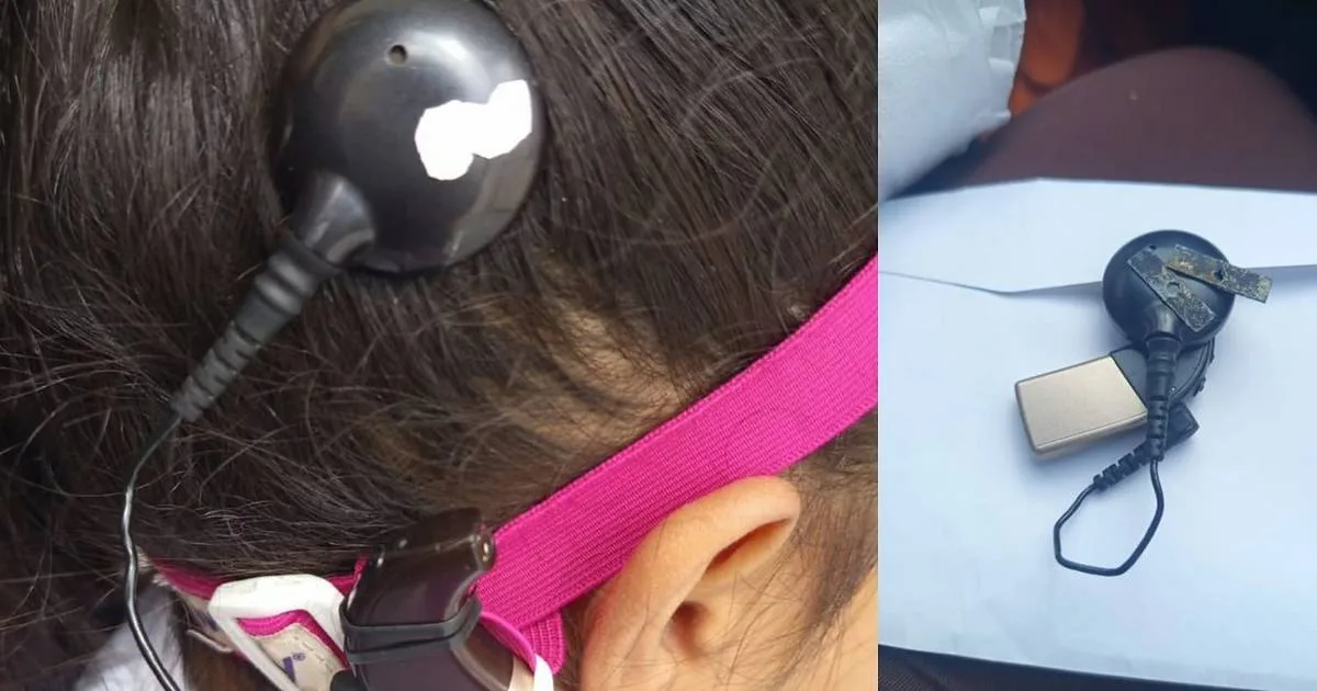 Rifan moto y bicicleta para que su hija de 7 años con hipoacusia vuelva a escuchar